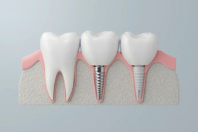 008sE9Shgy1hu2fzulclpj30x70m6tas-1